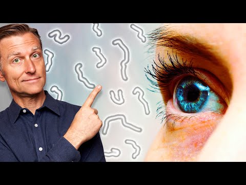 What Causes Eye Floaters and Dry Eyes?