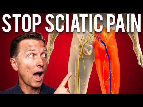 The Best STRETCH to Stop Sciatica Pain