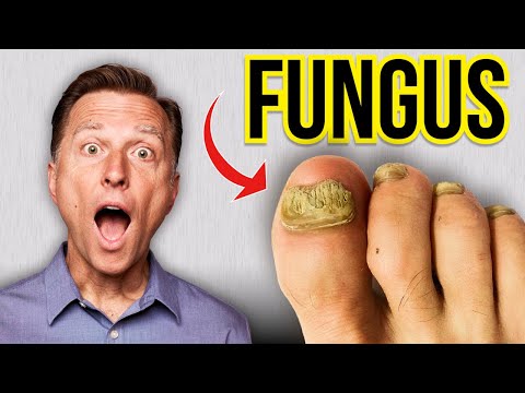 The Fastest Way to Get Rid of Toenail Fungus